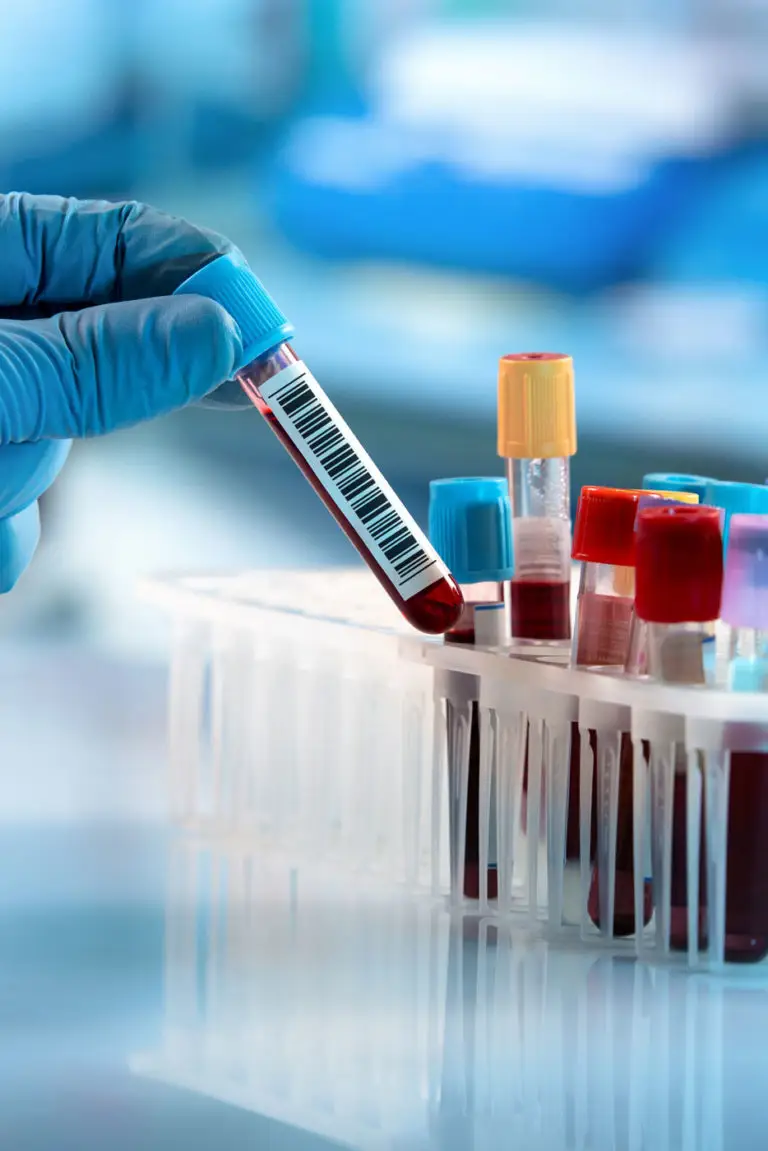Hormone, Hormontherapie, Hormonregulierung, Labordiagnostik